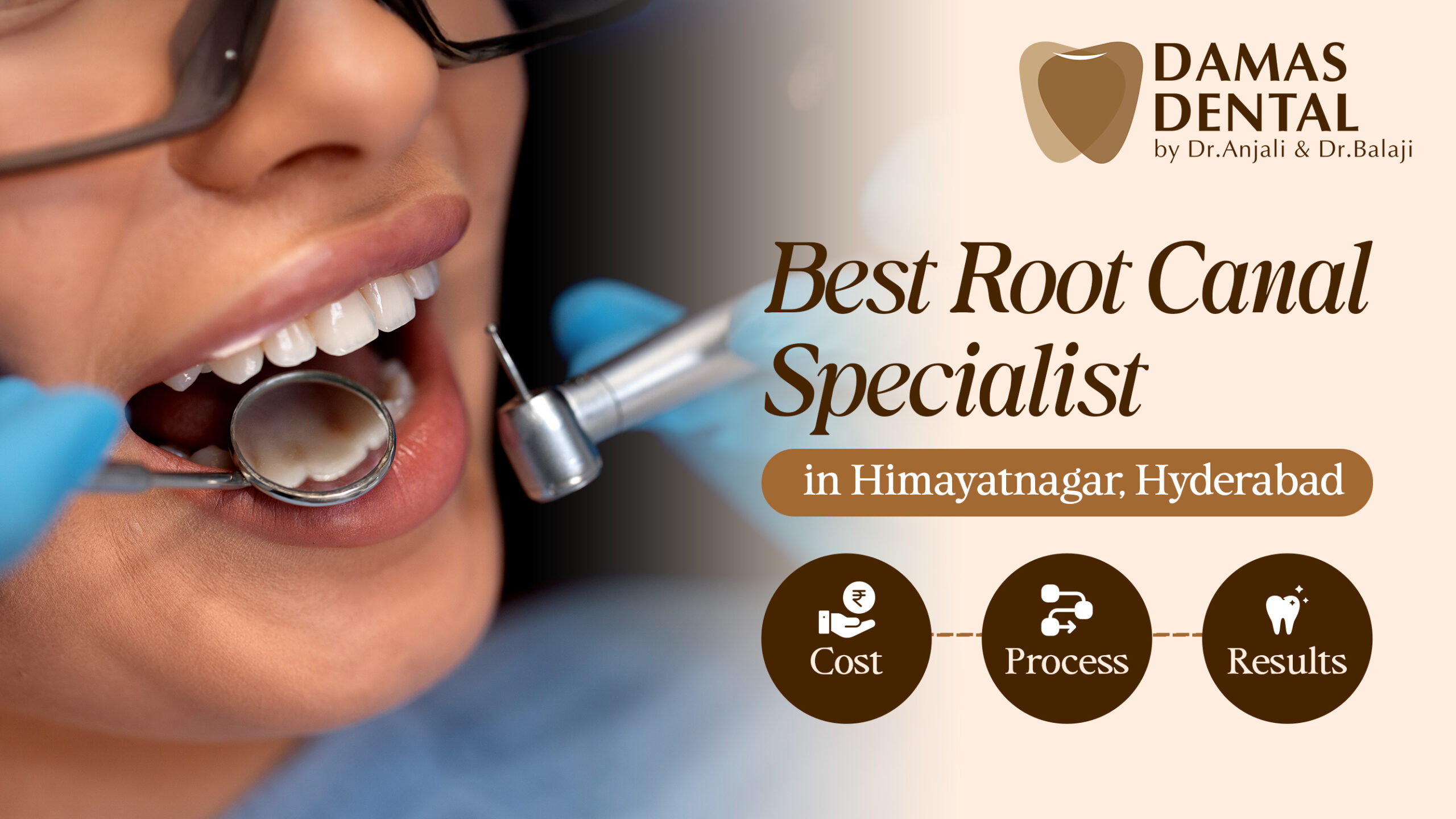 Best Root Canal Specialist in Himayatnagar, Hyderabad – Treatment ...